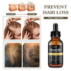 Ruahouine Hair Growth Treatment for Thicker Longer, 5% Minoxidil Biotin Hair Growth Serum Oil for Men and Women, Prevents Hair Loss and Thinning, 2.11 fl.oz