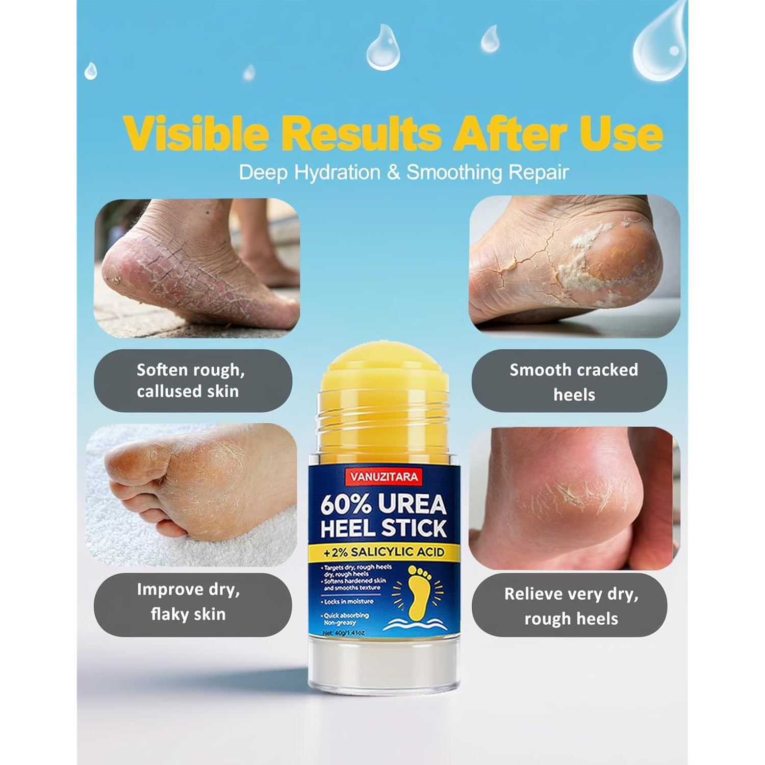 Urea Cream 60% with 2% Salicylic Acid, Foot Cream 60 Percent for Feet & Hands, Maximum Strength Urea Stick for Rough, Dry Cracked Feet Hands Elbows, Callus Remover, Skin Softener Balm 1.41oz