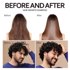 Biotin Rosemary Shampoo For Hair Growth, Strengthening For Thinning Hair Women & Men, Supports Scalp Health & Reduces Breakage (300Ml, Shampoo)