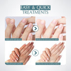 5 Pairs Hand Mask with Niacinamide, Deeply Moisturizing Hydrating Hand Masks for Dry Cracked Skin with Shea Butter, Dead Skin Remove, Easy to Use Exfoliating Glove Design for Women Men
