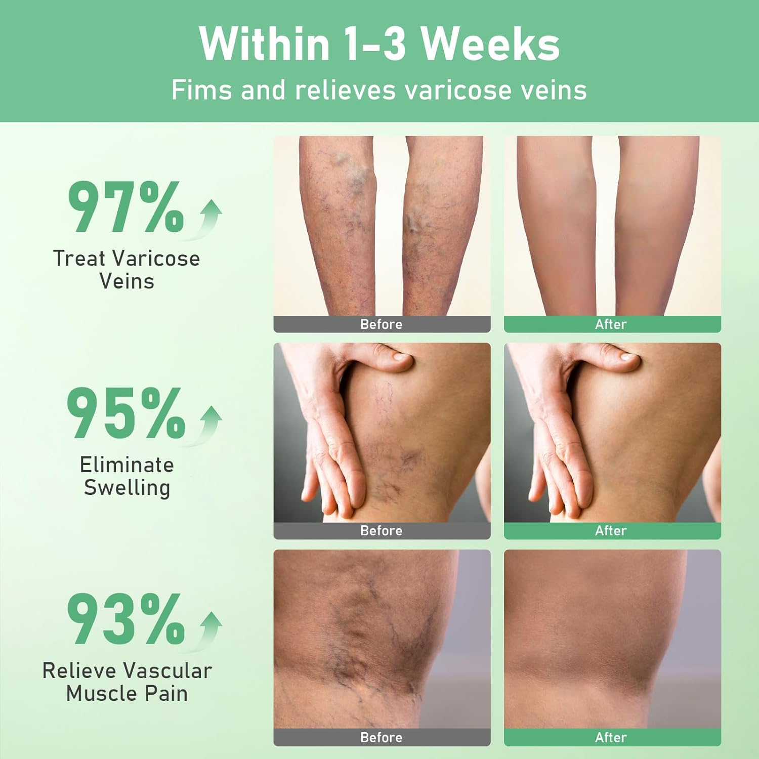 Healrize VeinTarget Microdarts Patch, Vein Target Microdarts Patch, Relieves Leg Discomfort, Moisturizes and Smooths Skin(3 Boxes)