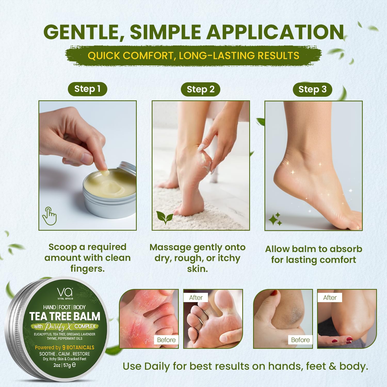 VITAL AFFAIR Tea Tree Oil Balm – Soothing Care for Rashes, Athlete’s Foot, Jock Itch, Bug Bites, Folliculitis, Cracked Feet, Dry, Flaky, Irritated Skin – For All Ages & Sensitive Skin - 2 oz