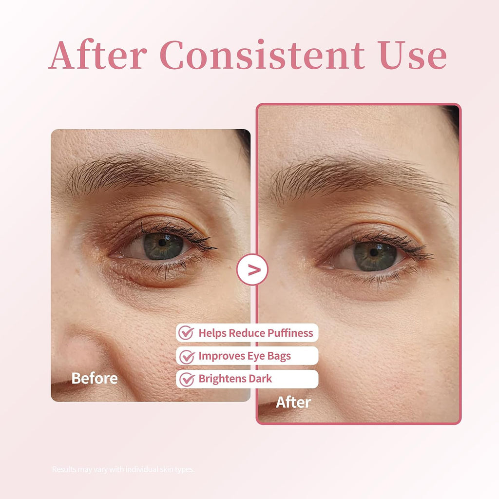 Retinol & Caffeine Under Eye Roller Serum | Xenjura Cooling Eye Cream For Puffy Eyes & Dark Circles | Anti Aging Wrinkle Remover For Fine Lines | Vegan Skincare (20Ml / 0.7 Fl Oz)