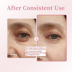 Retinol & Caffeine Under Eye Roller Serum | Xenjura Cooling Eye Cream For Puffy Eyes & Dark Circles | Anti Aging Wrinkle Remover For Fine Lines | Vegan Skincare (20Ml / 0.7 Fl Oz)