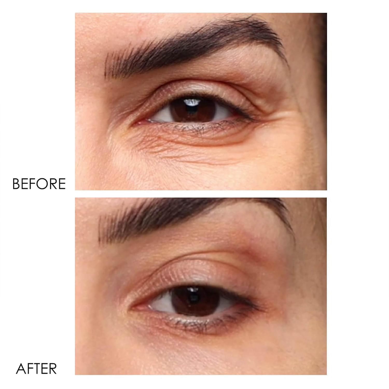 Dermelect Revitalite Eyelid & Dark Circle Corrector- Professional Strength, Anti-Aging Eye Cream With Peptides, Brightening & Tightening Ingredients- Dark Circles, Puffiness, Droopy Eyelids & Wrinkles