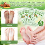Foot Peeling 3Pcs ＆ 5Pcs Moisturizing Foot Mask, Exfoliator Peel Calluses Dead Skin Callus Remover, Hydrating Foot Masks for Dry Cracked Feet, Repair Rough Heels＆Dry Skin for Baby Soft and Smooth Feet