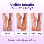 Foot Peeling Mask (6 pairs) Exfoliating Foot Mask for Dry Cracked Feet with Lavender & Shea Butter, Dead Skin & Callus Remover for Feet, Exfoliating Socks for Women & Men, One Size Fits Most
