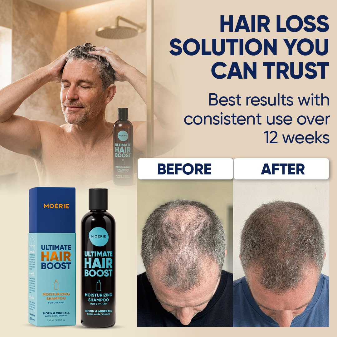Moerie Hair Growth Shampoo For Men And Women, Hair Loss Solution With Biotin And Rosemary, Moisturizing Shampoo For Thinning Hair – Ultimate Boost For All Hair Types, Triple Set