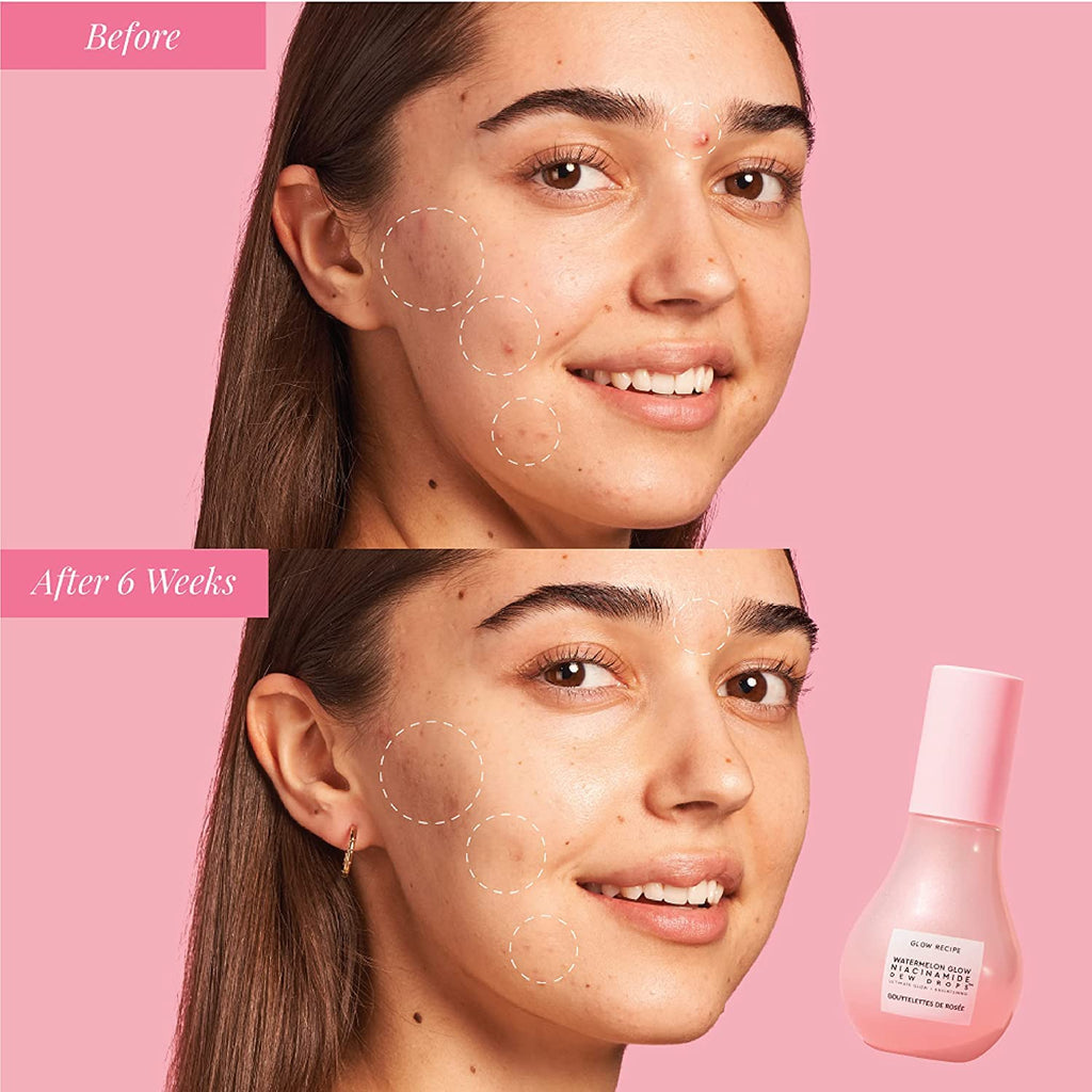 Glow Recipe Watermelon Niacinamide Dew Drops, Korean Niacinamide Serum Drops, Hydrating Face Serum + Primer & Liquid Highlighter, Hyaluronic Acid, Dewy Glow (40Ml)