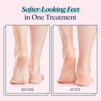 SpaLife Moisturizing Foot Sockies | Foot Mask for Dry Cracked Feet Intensive Repair Treatment | Tea Tree Oil Softening Booties | Callus Remover Alternative | Self Care Gifts for Women | 8 Pack