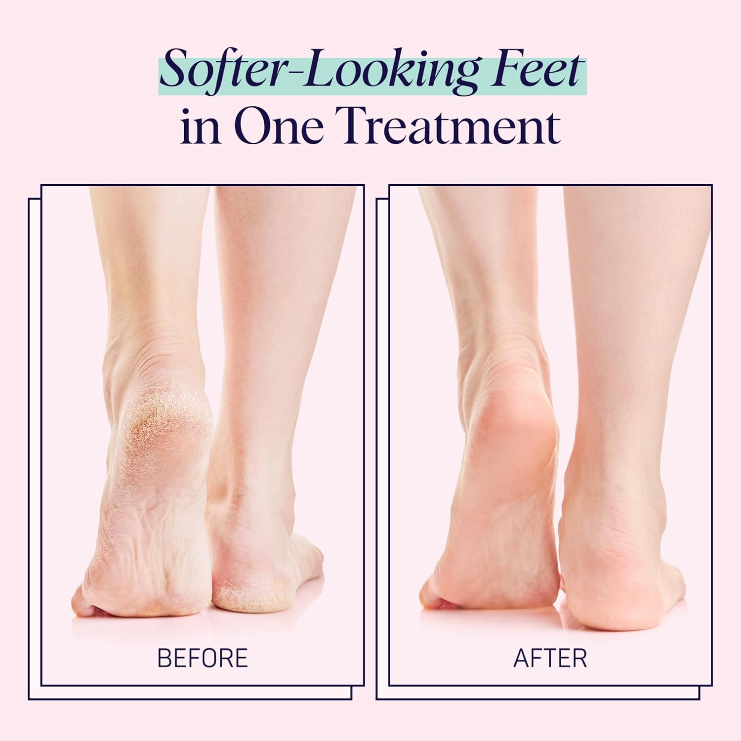 SpaLife Moisturizing Foot Sockies | Foot Mask for Dry Cracked Feet Intensive Repair Treatment | Tea Tree Oil Softening Booties | Callus Remover Alternative | Self Care Gifts for Women | 8 Pack