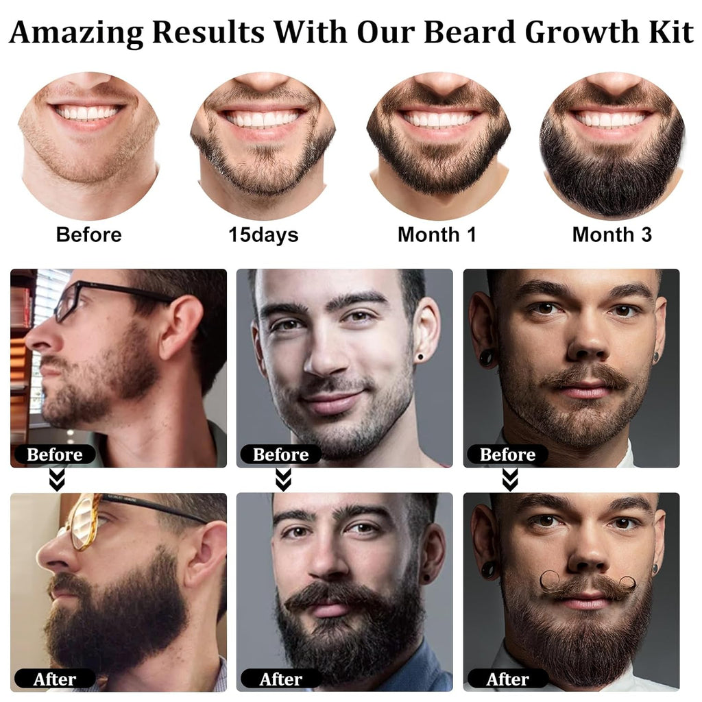 RAFFIN Beard Growth Kit, Beard Growth Oil (2Oz) w/3 X Thickening Biotin & Castor Oil for Spot/Patchy Beard, Achieve Fuller, Thicker, Healthier Beard, Birthday Gifts for Men Him Boyfriend Husband Dad