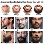 RAFFIN Beard Growth Kit, Beard Growth Oil (2Oz) w/3 X Thickening Biotin & Castor Oil for Spot/Patchy Beard, Achieve Fuller, Thicker, Healthier Beard, Birthday Gifts for Men Him Boyfriend Husband Dad