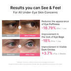Medicube Eye Patch Pdrn Caffeine Collagen | Gel Eye Patches For The Appearance Of Dark Circles, Undereye Bags | Firming, Age-Defying Care With Retinol, Collagen | Korean Skincare | 30 Pairs