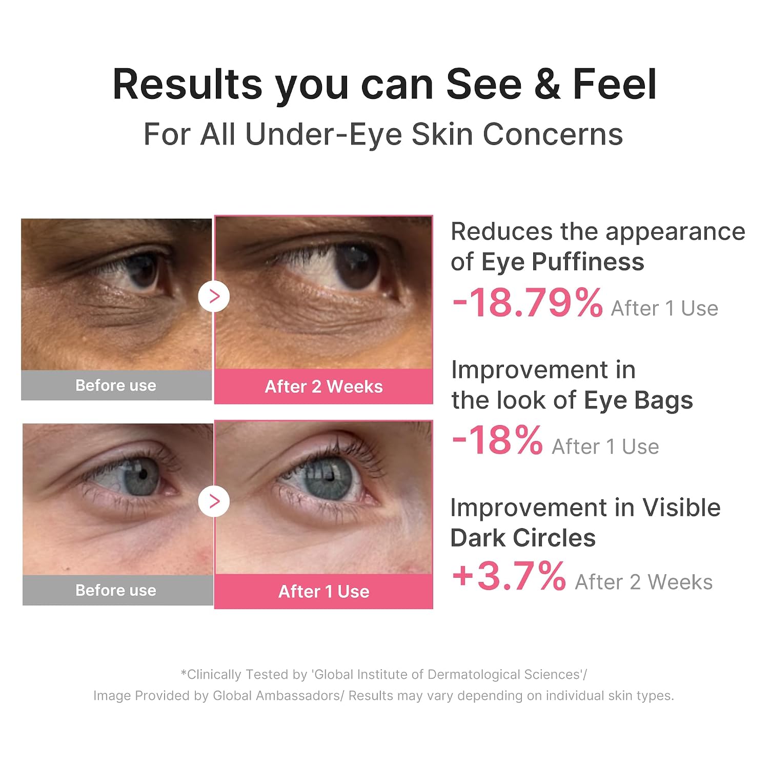 Medicube Eye Patch Pdrn Caffeine Collagen | Gel Eye Patches For The Appearance Of Dark Circles, Undereye Bags | Firming, Age-Defying Care With Retinol, Collagen | Korean Skincare | 30 Pairs