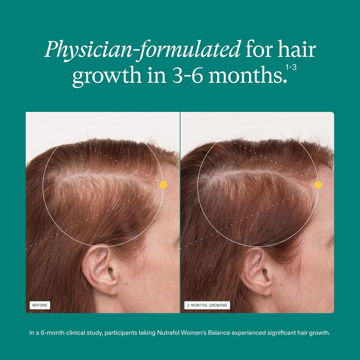 Nutrafol Women's Balance Hair Growth Supplements, Ages 45 and Up, Clinically Tested for Visibly Thicker Hair and Scalp Coverage, Dermatologist Recommended - 1 Month Supply