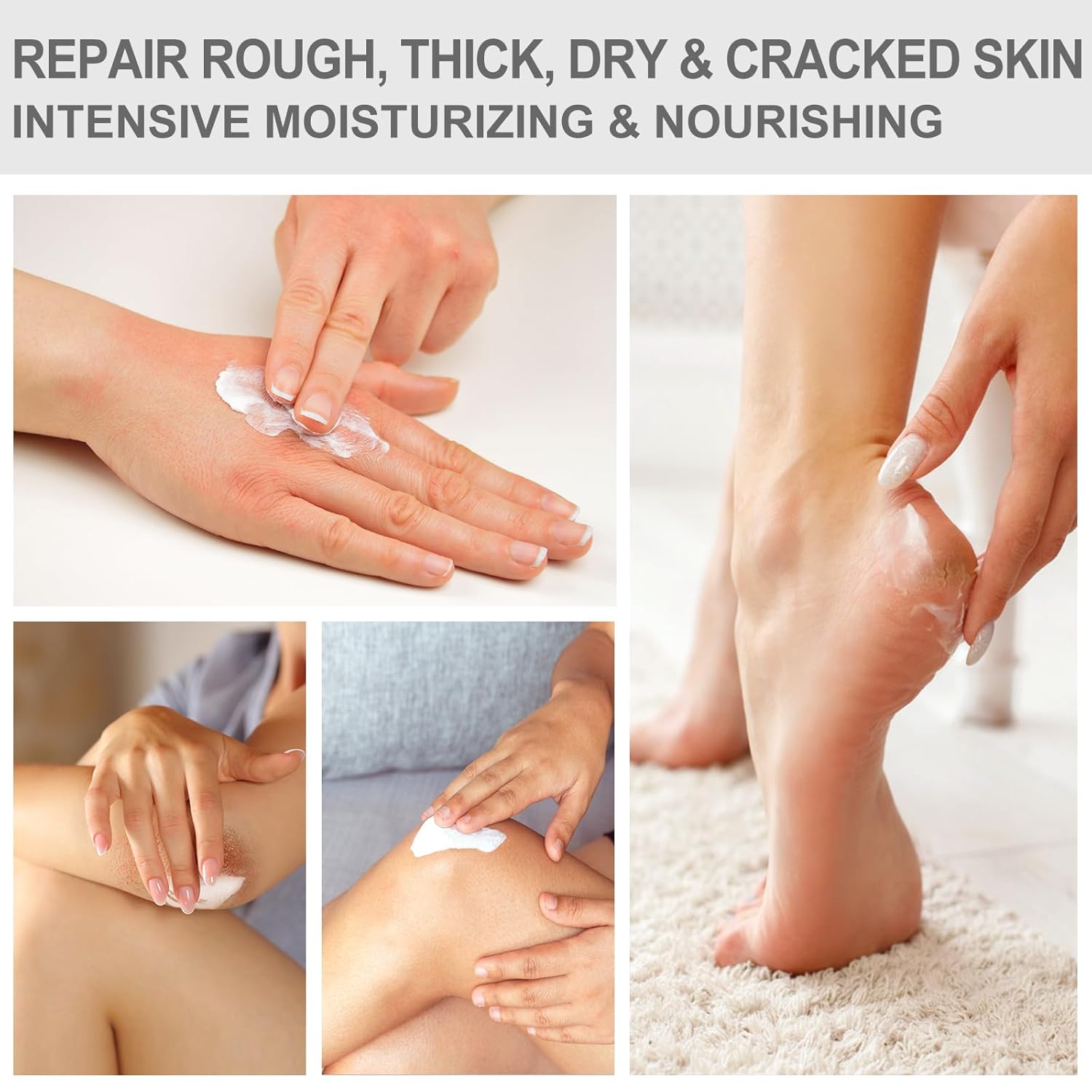 Urea Cream 40 Percent - Foot & Hand Cream for Dry, Cracked Heels, Feet, Knees, Elbows, and Hands - Maximum Strength Urea Lotion for Softening and Moisturizing