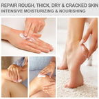 Urea Cream 40 Percent - Foot & Hand Cream for Dry, Cracked Heels, Feet, Knees, Elbows, and Hands - Maximum Strength Urea Lotion for Softening and Moisturizing