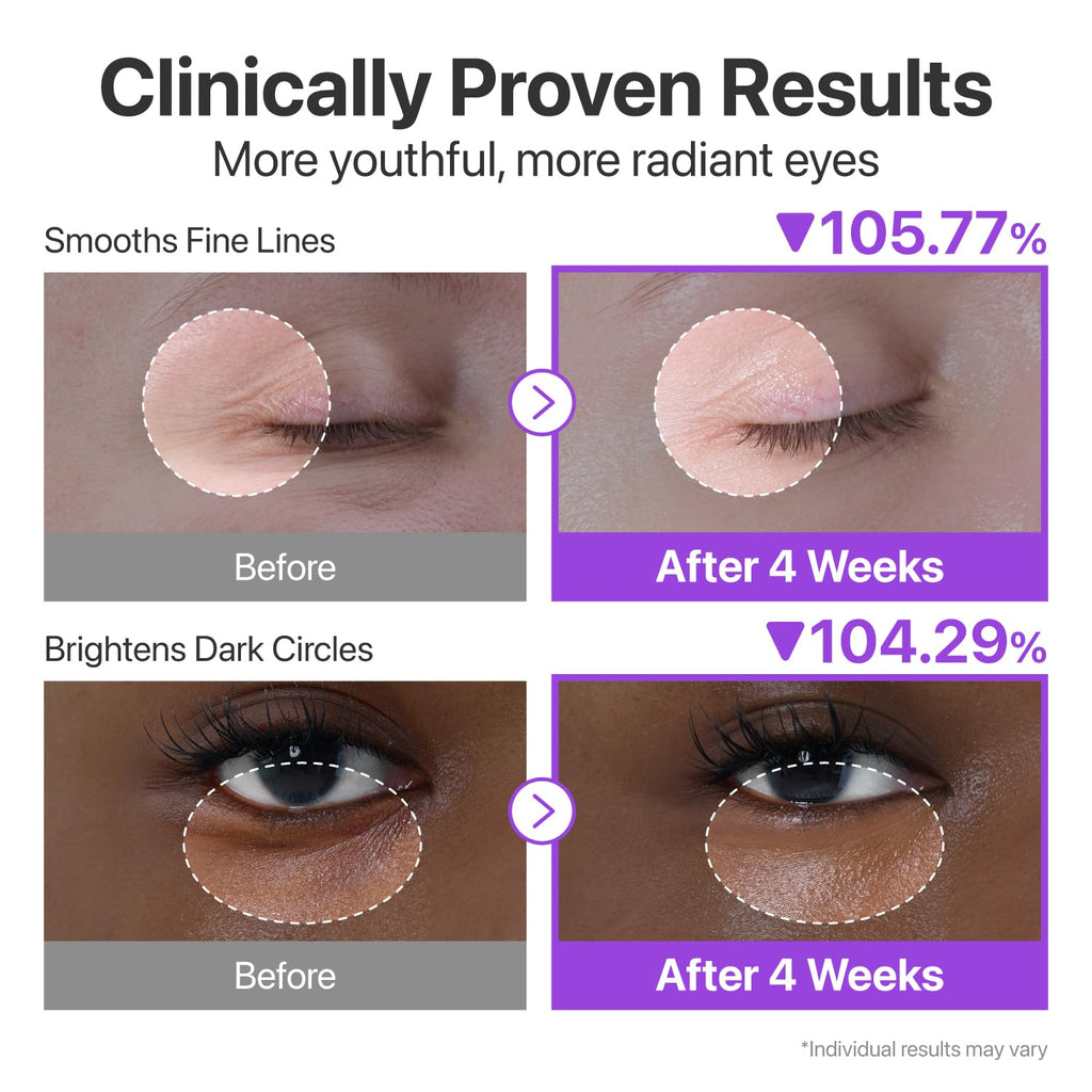 Numbuzin No.9 Nad+ Retinol Eye Cream For Dark Circles, Puffiness & Anti-Aging Eye Serum With 50 Peptides, Niacinamide & Ceramide, Reduces Wrinkles & Fine Lines, Korean Eye Cream, 0.33 Fl Oz
