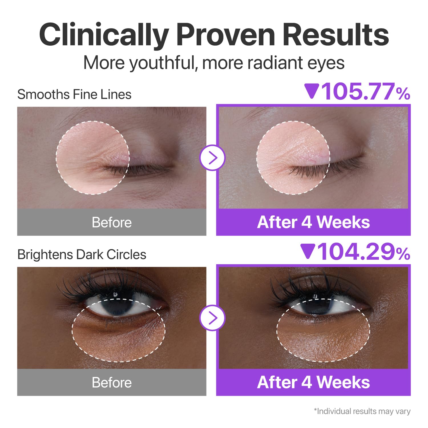 Numbuzin No.9 Nad+ Retinol Eye Cream For Dark Circles, Puffiness & Anti-Aging Eye Serum With 50 Peptides, Niacinamide & Ceramide, Reduces Wrinkles & Fine Lines, Korean Eye Cream, 0.33 Fl Oz