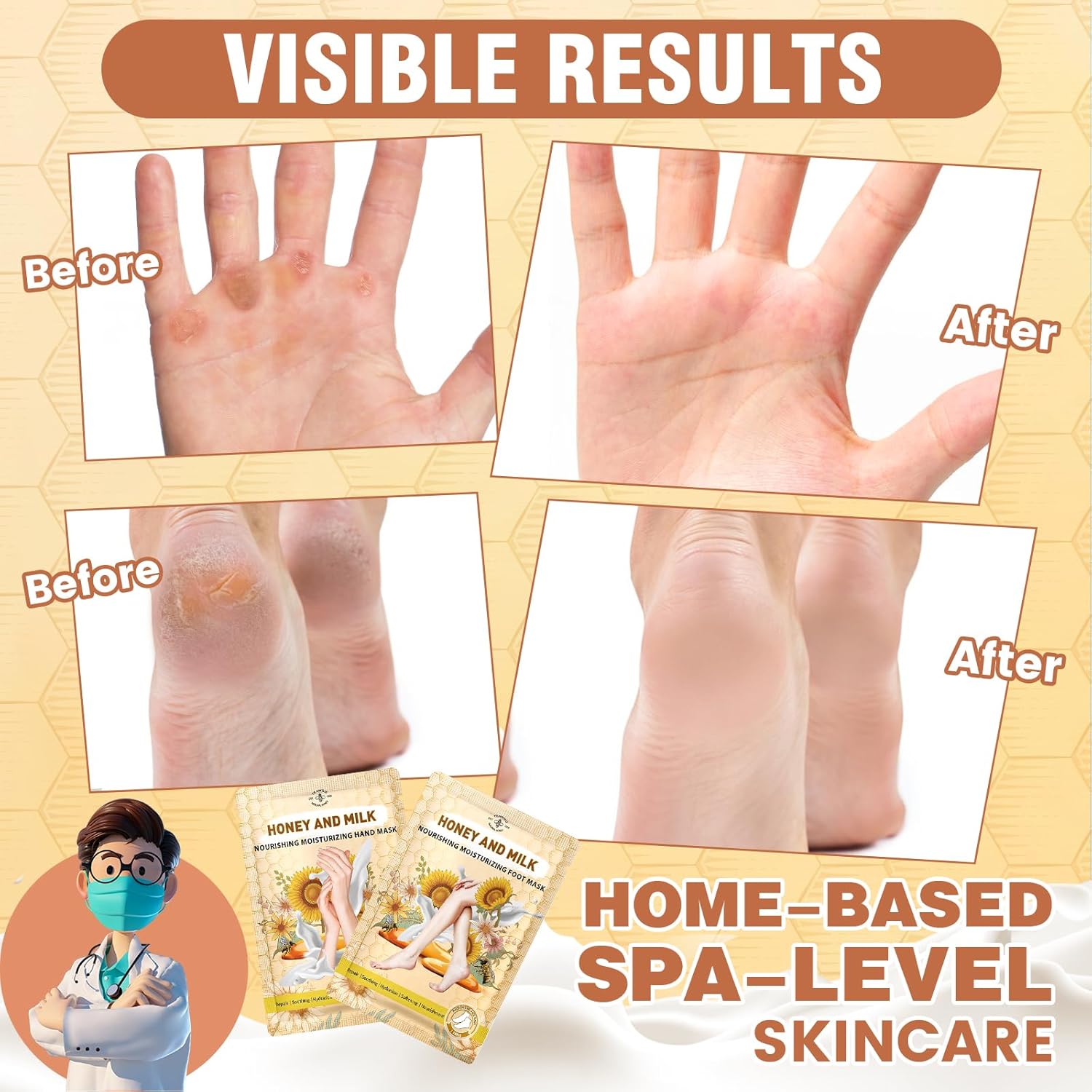 TEAWOO 18 Pairs Moisturizing Hand & Foot Masks with Honey, Milk, Vitamin E & Glycerin, Intensely Hydrating Foot Mask for Dry Cracked Feet, Moisturizing Socks for Cracked Heel Treatment
