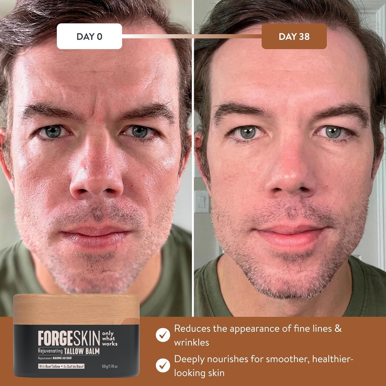 Forge Skin Beef Tallow Balm Moisturizer For Men Skin Care - Face + Body Anti Aging Wrinkle Defense, Hydration Cream - Natural Skincare Lotion (1.7 Oz)