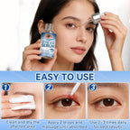Stye Eye Treatment, 30Ml Natural Eye Serum, Eye Stye Relief Serum For Eye Styes, Blepharitis, Chalazions And Dry Eyes Treatment, Daily Area Cleansing, Relieves Dryness And Restores Healthier Skin