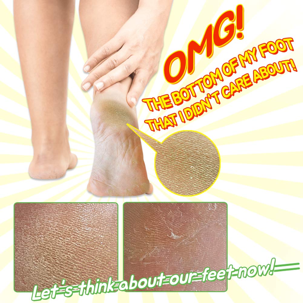 Elizavecca/Foot Peel /1 Foot Pack 2 Pairs Foot Mask - Boots for Exfoliating/foot pack review/foot pack before and after