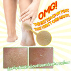 Elizavecca/Foot Peel /1 Foot Pack 2 Pairs Foot Mask - Boots for Exfoliating/foot pack review/foot pack before and after