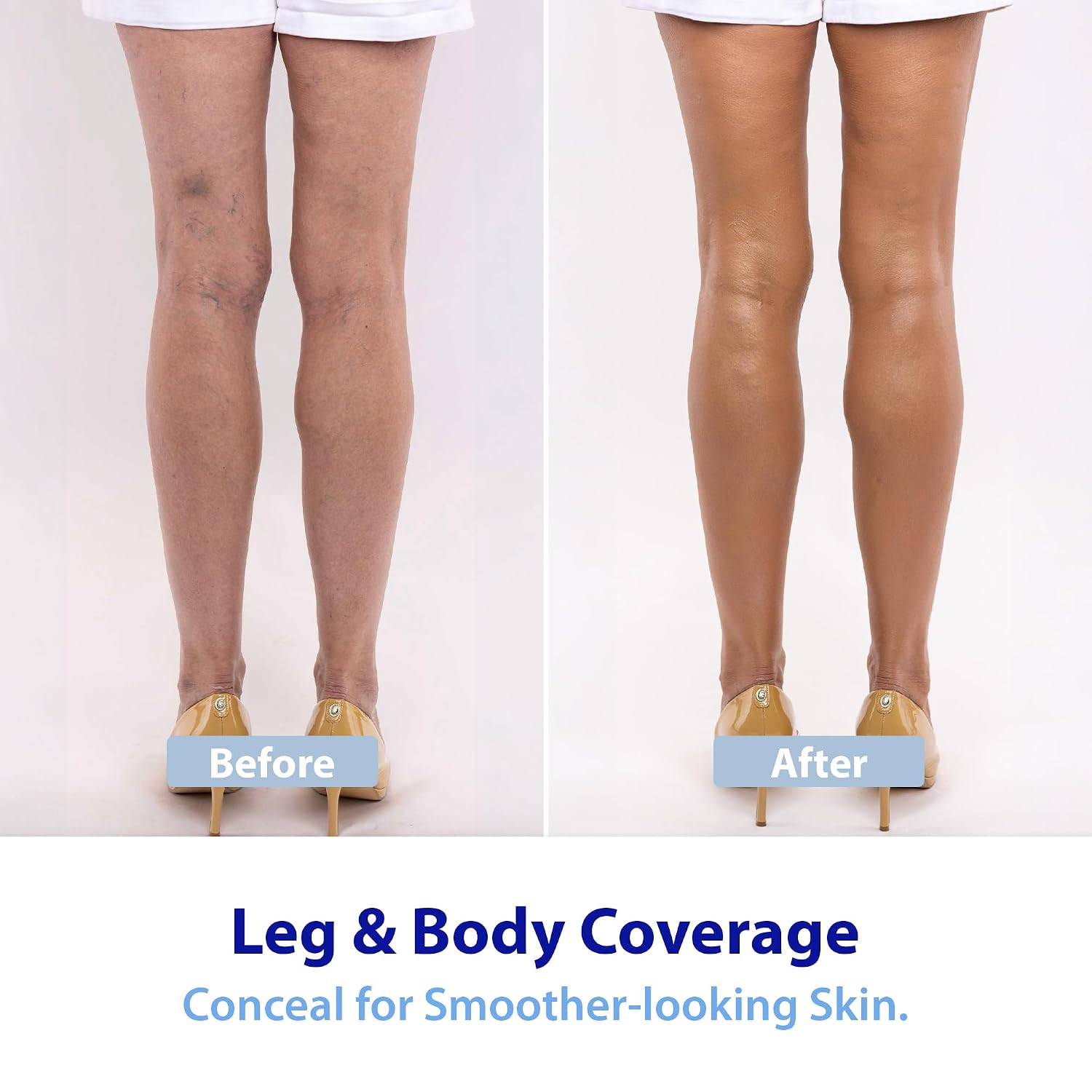 Dr. Denese Glow Younger Body Concealer 3.4 Oz – Leg & Body Makeup For Veins, Bruises, Scars, Discoloration, Age And Sun Spots – Full Coverage Concealer & Hydrating Transfer-Resistant Cream – Natural