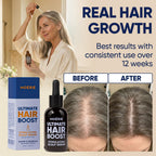 Moerie Ultimate Hair Growth Serum For Natural Hair Regrowth & Thickening - Anti Thinning & Hair Loss Treatment For Women - Rapid Hair Growth Products - Scalp Oil Alternative - 1.69 Fl Oz / 50 Ml