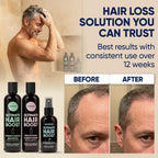 Moerie Hair Growth Shampoo, Conditioner And Spray For Men And Women, Hair Loss Solution With Biotin And Rosemary, Thickening Hair Regrowth Set With Serum Level Care For Thinning Hair