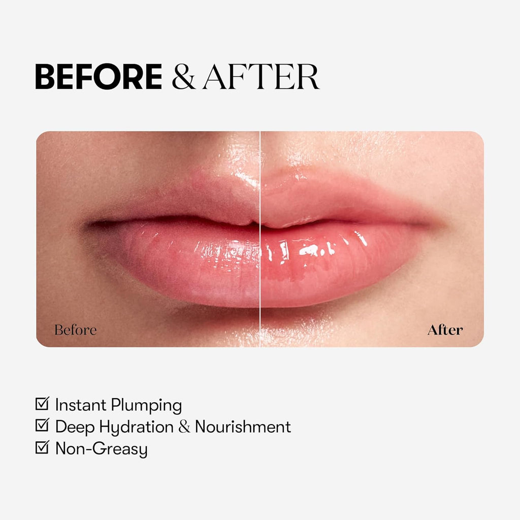 VT COSMETICS Reedle Shot Lip Plumper, Hydrating & Volumizing Clear Lip Gloss, Microneedling Effect & Hyaluronic Acid for Fuller, Smoother Lips, 0.15 oz (4.3 g) (Beginner)