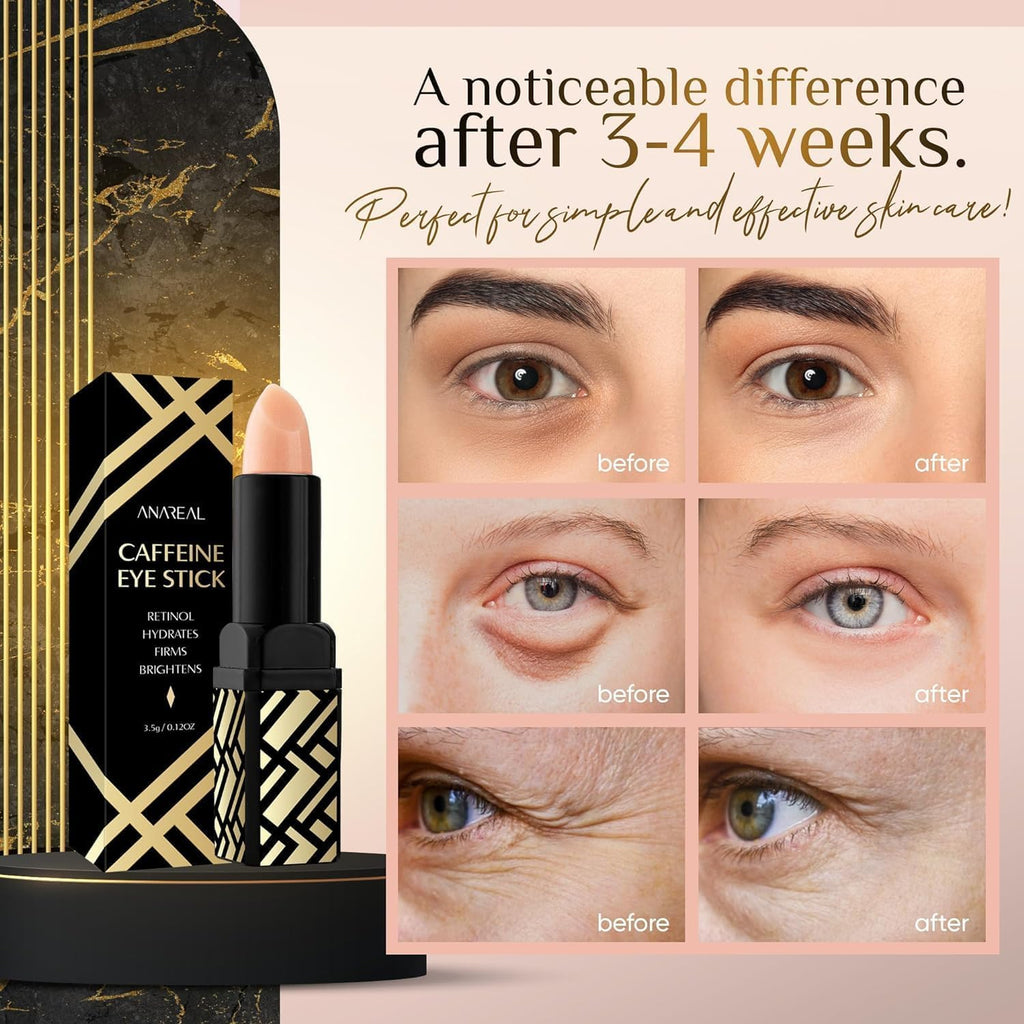 Anareal Caffeine Under Eye Balm Stick (1 Pack) – Hydrating Eye Care For Dark Circles & Puffiness, Cooling Eye Balm Stick For Eyes, Face & Under Eye Bags