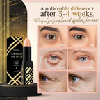 Anareal Caffeine Under Eye Balm Stick (1 Pack) – Hydrating Eye Care For Dark Circles & Puffiness, Cooling Eye Balm Stick For Eyes, Face & Under Eye Bags
