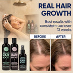Moerie Hair Growth Shampoo, Conditioner And Spray For Men And Women, Hair Loss Solution With Biotin And Rosemary, Thickening Hair Regrowth Set With Serum Level Care For Thinning Hair