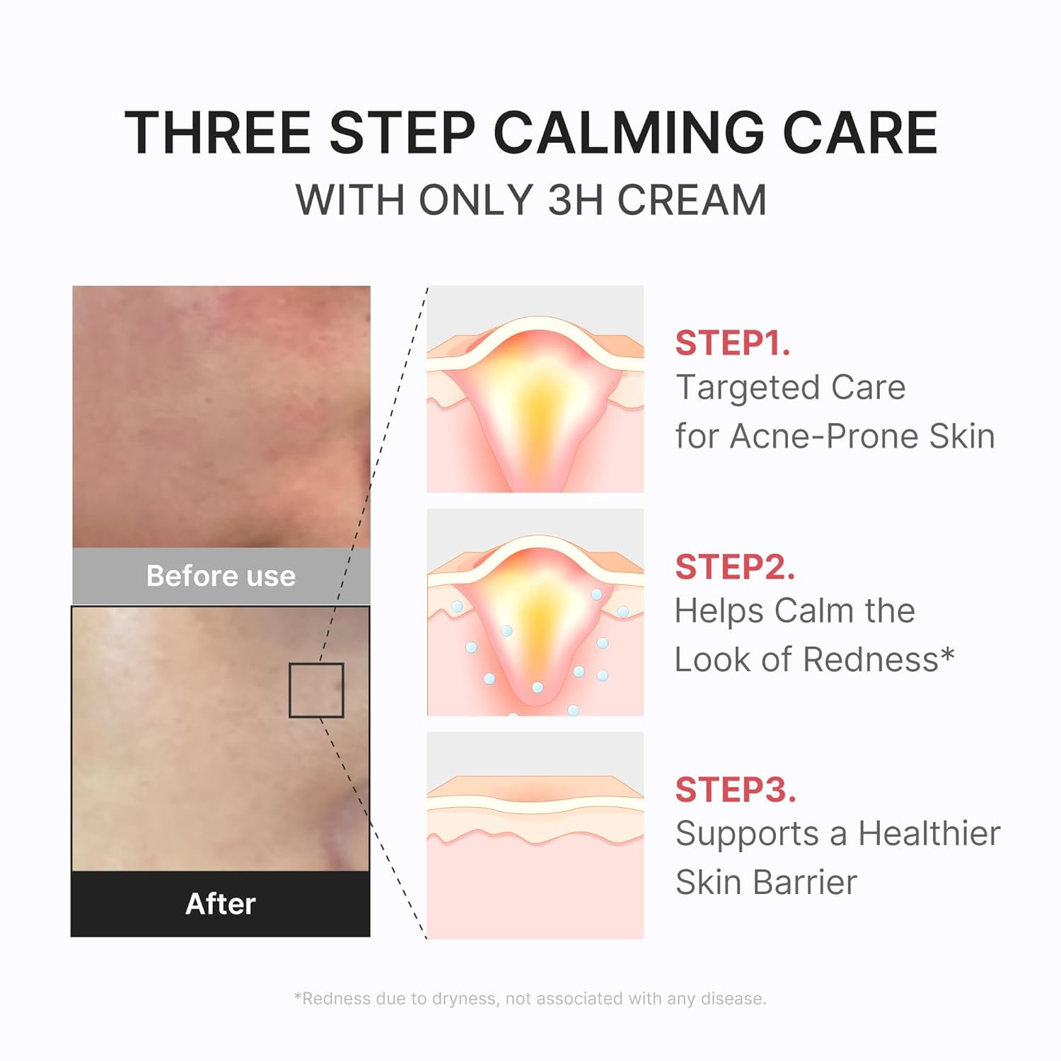 medicube 3H Daily Relief Cream | Daily Soothing Moisturizer for All Skin Types | Lightweight Comforting Cream Ideal For Use After Spot Care | Guaiazulene, Centella, Ceramide for Balance and Hydration