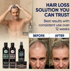 Moérie Hair Growth Shampoo, Conditioner, Spray And Mask For Men And Women, Hair Loss Solution With Biotin And Rosemary, Thickening Hair Regrowth Set With Serum Level Care For Thinning Hair, 4 Set