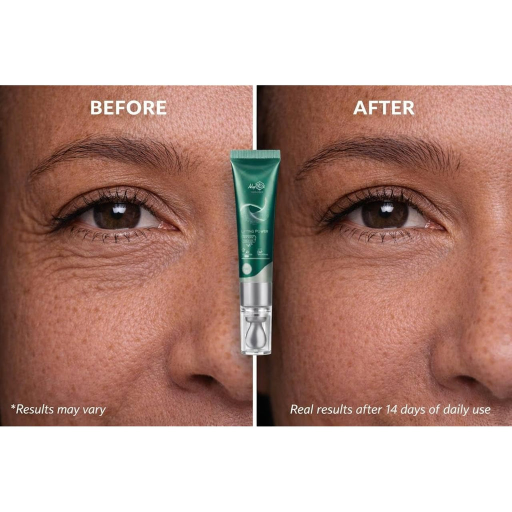 Lifting Power Eye Fluid – Eyelid Lifting Treatment For Hooded Eyes & Fine Lines – Multi-Peptide Eye Serum With Ceramide Ng, Hyaluronic Acid & Palmitoyl Tripeptide-1 – 0.5 Fl Oz / 15 Ml