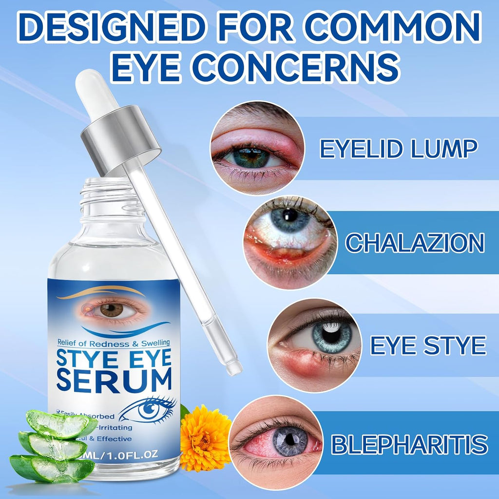 Stye Eye Treatment, 30Ml Natural Eye Serum, Eye Stye Relief Serum For Eye Styes, Blepharitis, Chalazions And Dry Eyes Treatment, Daily Area Cleansing, Relieves Dryness And Restores Healthier Skin