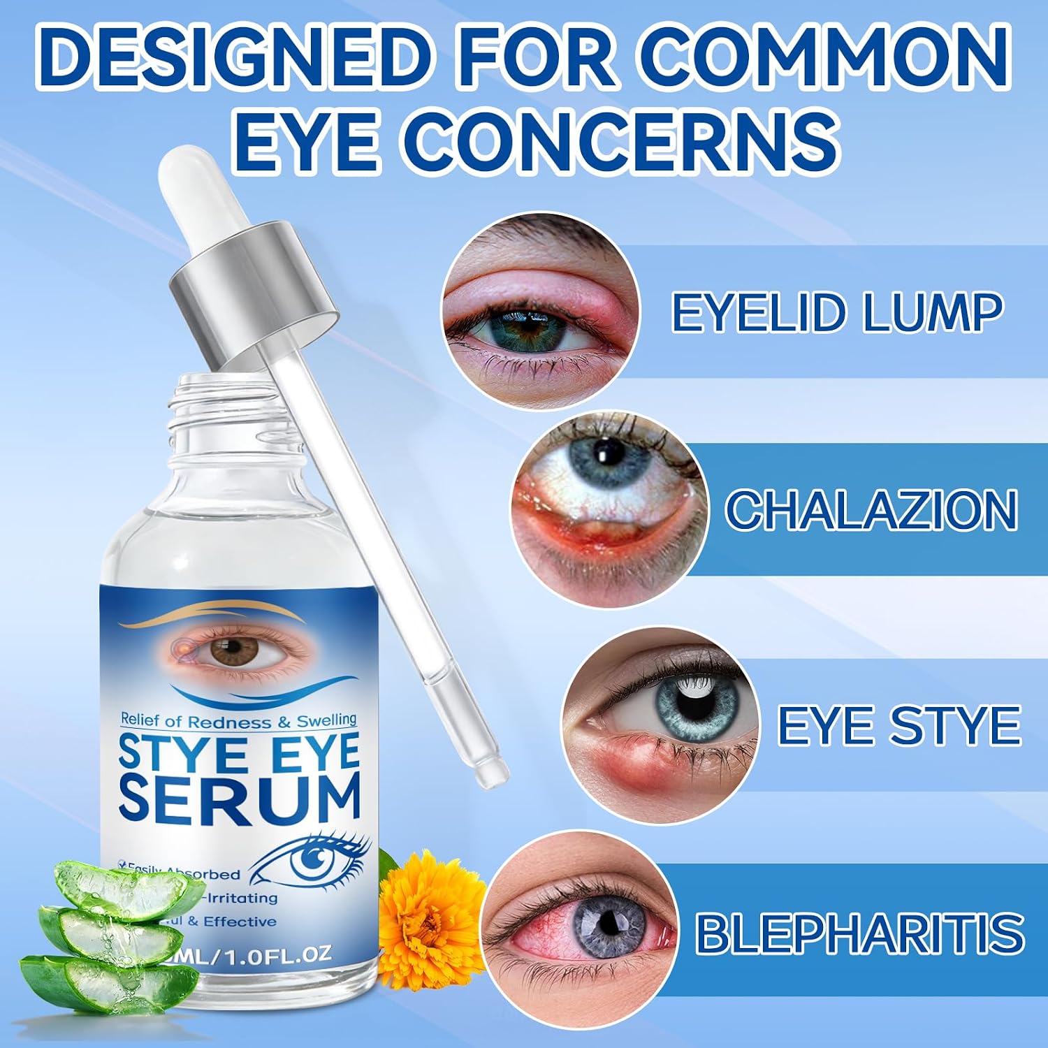 Stye Eye Treatment, 30Ml Natural Eye Serum, Eye Stye Relief Serum For Eye Styes, Blepharitis, Chalazions And Dry Eyes Treatment, Daily Area Cleansing, Relieves Dryness And Restores Healthier Skin