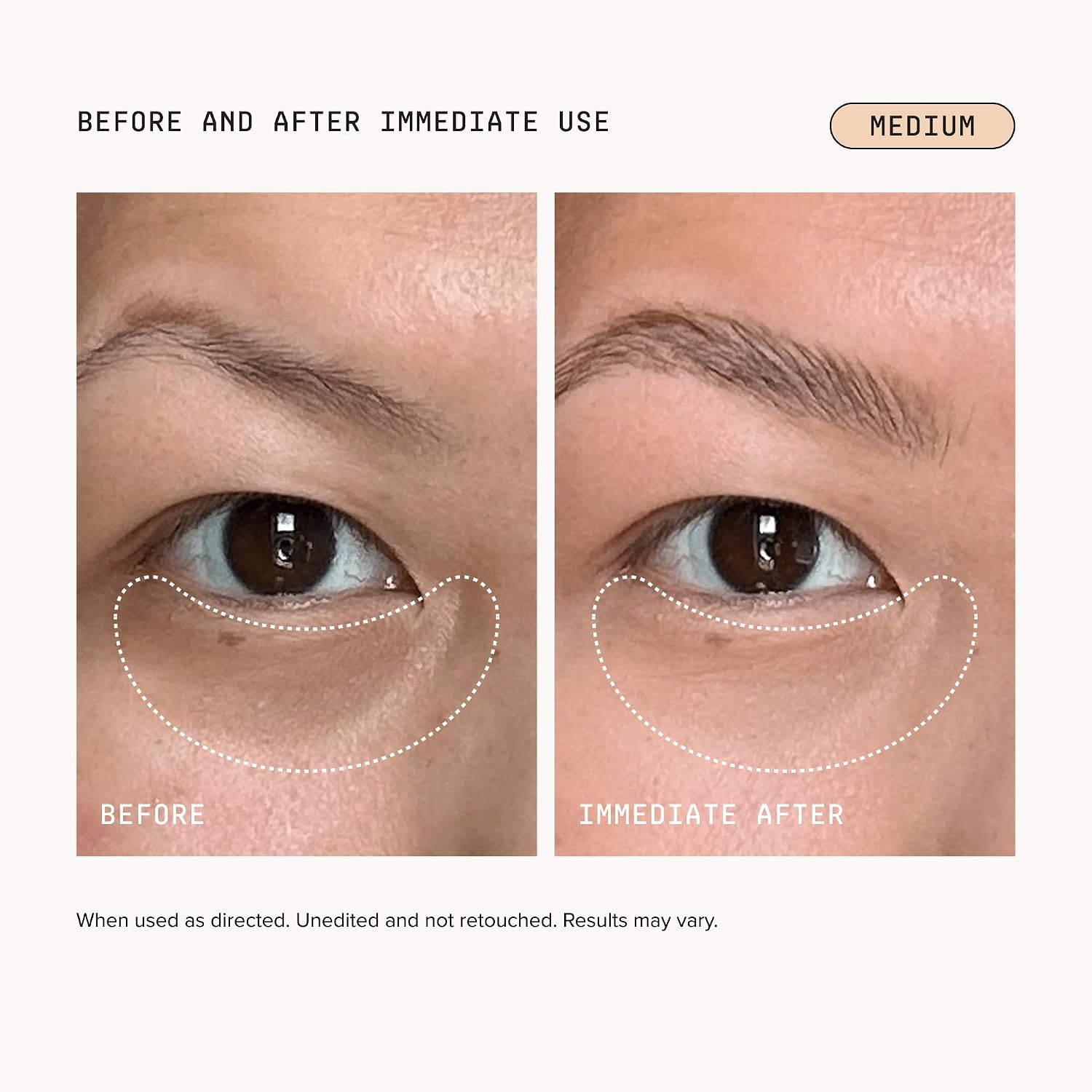Drmtlgy Luminous Eye Corrector Spf 41 – Medium – Under Eye Color Corrector For Dark Circles – Hydrating Anti-Aging Tinted Eye Cream, Mineral Broad Spectrum Sun Protection, 0.25 Fl Oz / 7 Ml