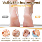 40% Urea Cream for Feet – Maximum Strength Foot Cream for Dry Cracked Heels & Calluses, Deep Softening Heel Repair, Urea Lotion for Body Hydration, Fast-Absorbing Foot Moisturizer for Rough Skin