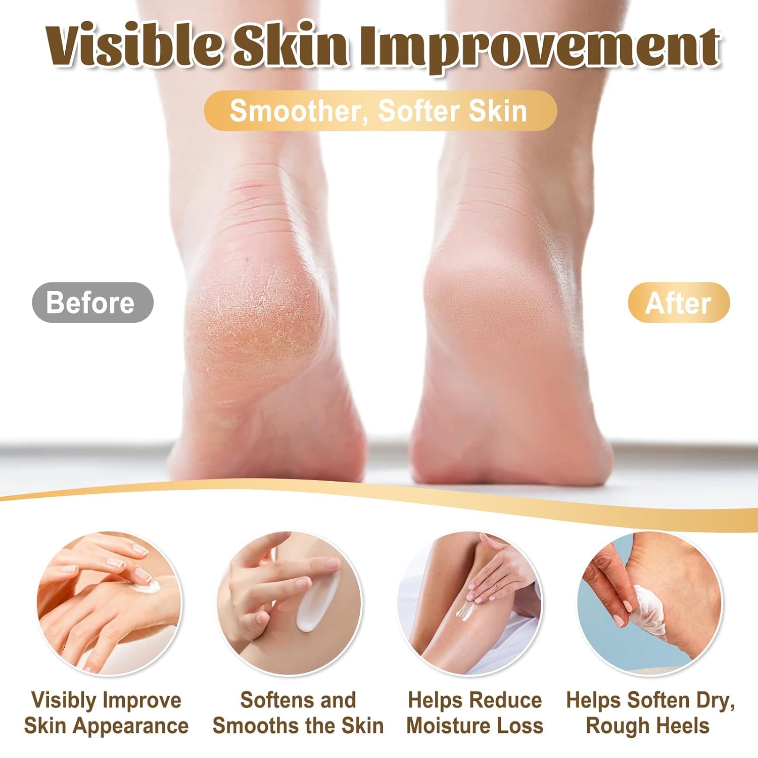 40% Urea Cream for Feet – Maximum Strength Foot Cream for Dry Cracked Heels & Calluses, Deep Softening Heel Repair, Urea Lotion for Body Hydration, Fast-Absorbing Foot Moisturizer for Rough Skin