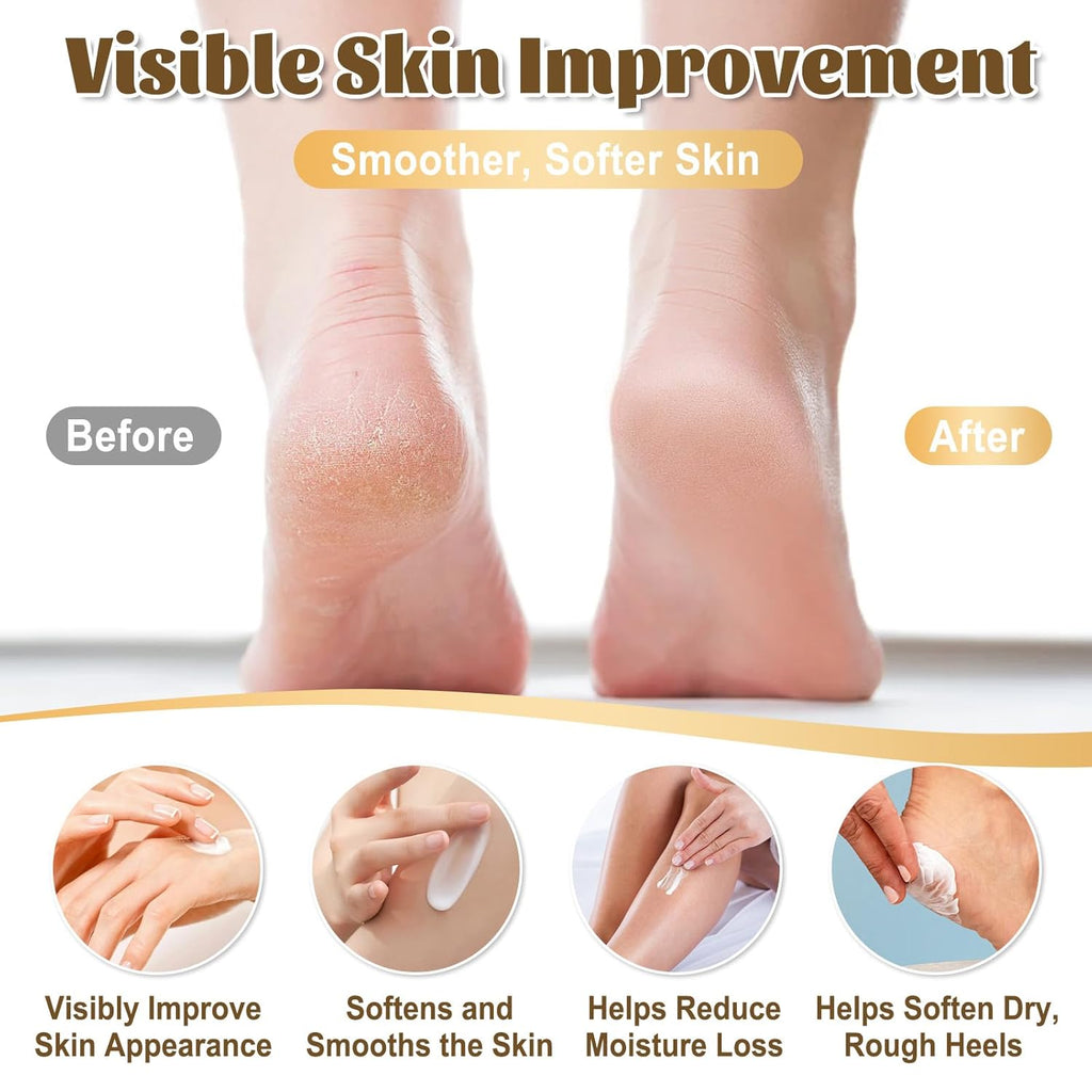40% Urea Cream for Feet – Maximum Strength Foot Cream for Dry Cracked Heels & Calluses, Deep Softening Heel Repair, Urea Lotion for Body Hydration, Fast-Absorbing Foot Moisturizer for Rough Skin