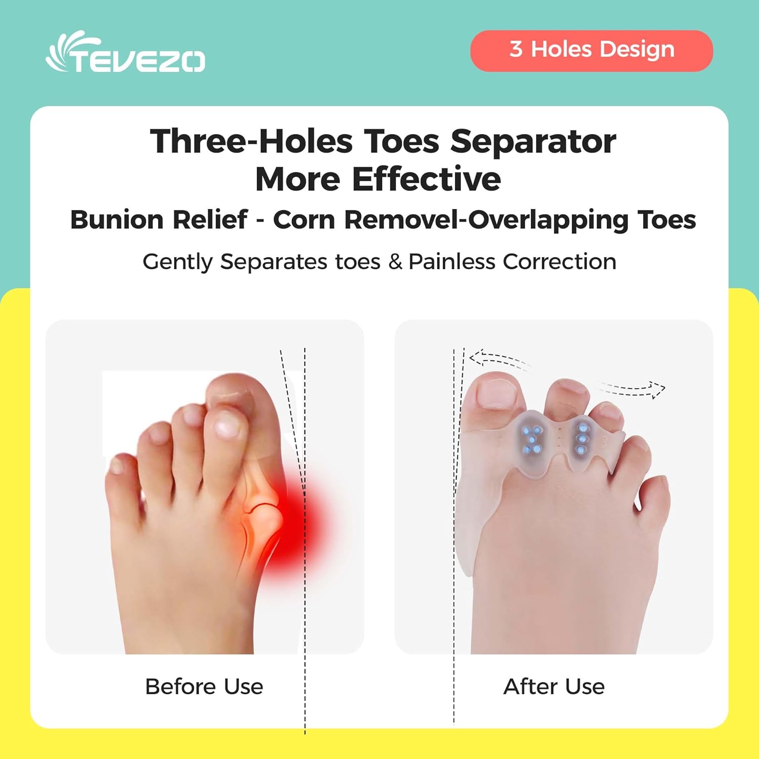 Toe Spacers & Bunion Corrector for KidsMenWomen|Corn Callus Removers|Bunion Relief|Overlapping Toes Separators (Toe Corrector Set (1 Pair, 20 ct Fillers), Small-Kids)