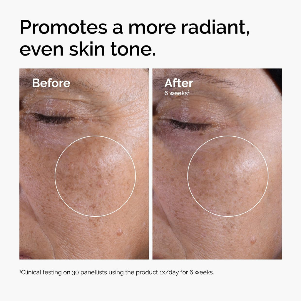 The Ordinary Glycolic Acid 7% Exfoliating Toner, Brightening And Smoothing Daily Toner For More Even-Looking Skin Tone