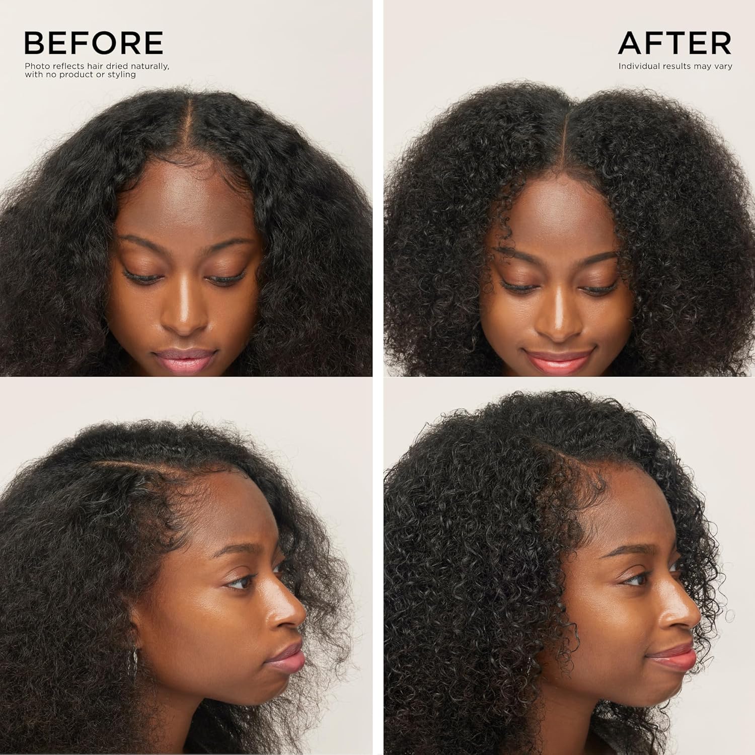 Dr. Groot Award-Winning Hair Thickening Serum for Hair Loss, Thinning Hair, Korean Hair Care, Scalp Treatment, Clinically Tested, Thicker, Reduces Oil, Roll On