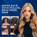 5% Minoxidil Hair Growth for Men and Women: Regrowth Topical Solution for Beard Spray Kit - Extra Strength Treatment with Minoxidil and Biotin for Hair loss & Thinning to Grow Thicker Serum - 2PCS