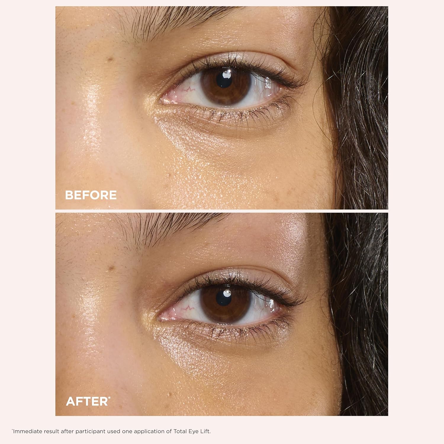 Clarins Total Eye Lift | Anti Aging Eye Cream | Targets Wrinkles, Crow'S Feet, Dark Circles And Puffiness For A Visible Eye Lift In 30 Seconds | Refillable